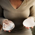 Qual o formato mais bonito de Silicone