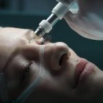 Blefaropastia prejudica a visão? entenda os possíveis riscos e cuidados